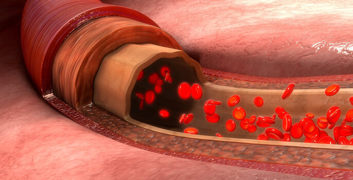 BioFluid Mechanics