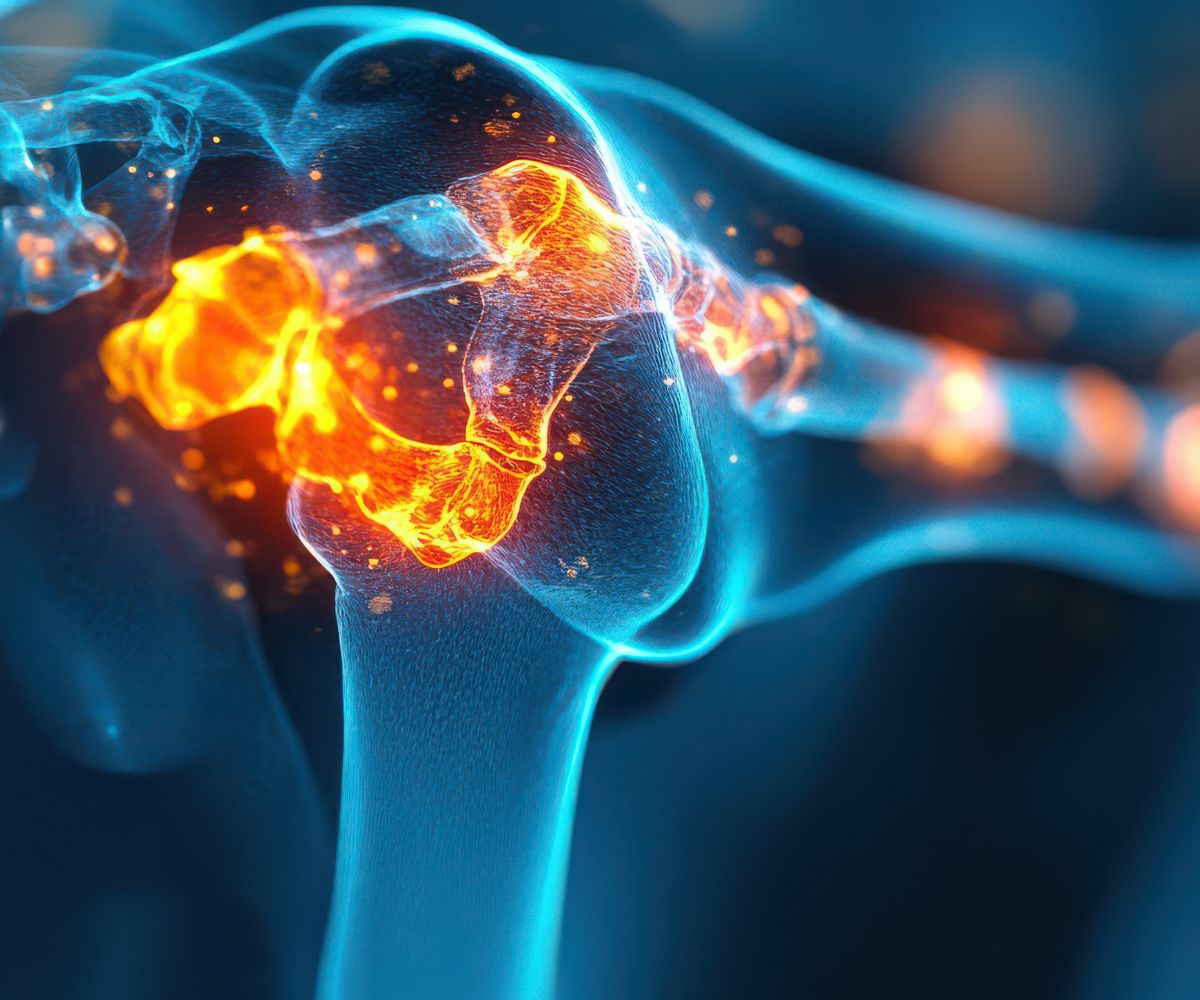 Musculoskeletal 