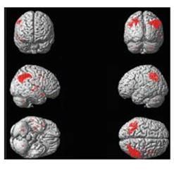 neuroimaging