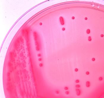 Antibiotic Resistance Epidemiology