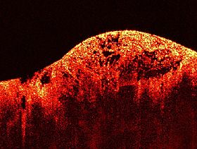 Martin Leahy Imaging Seminar