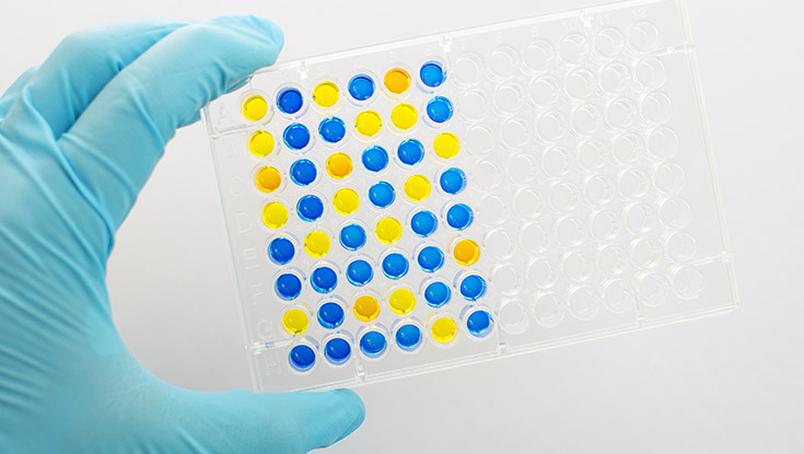 University of Galway