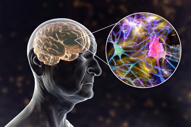 Neurodegenerative Disorders and Neuroregeneration