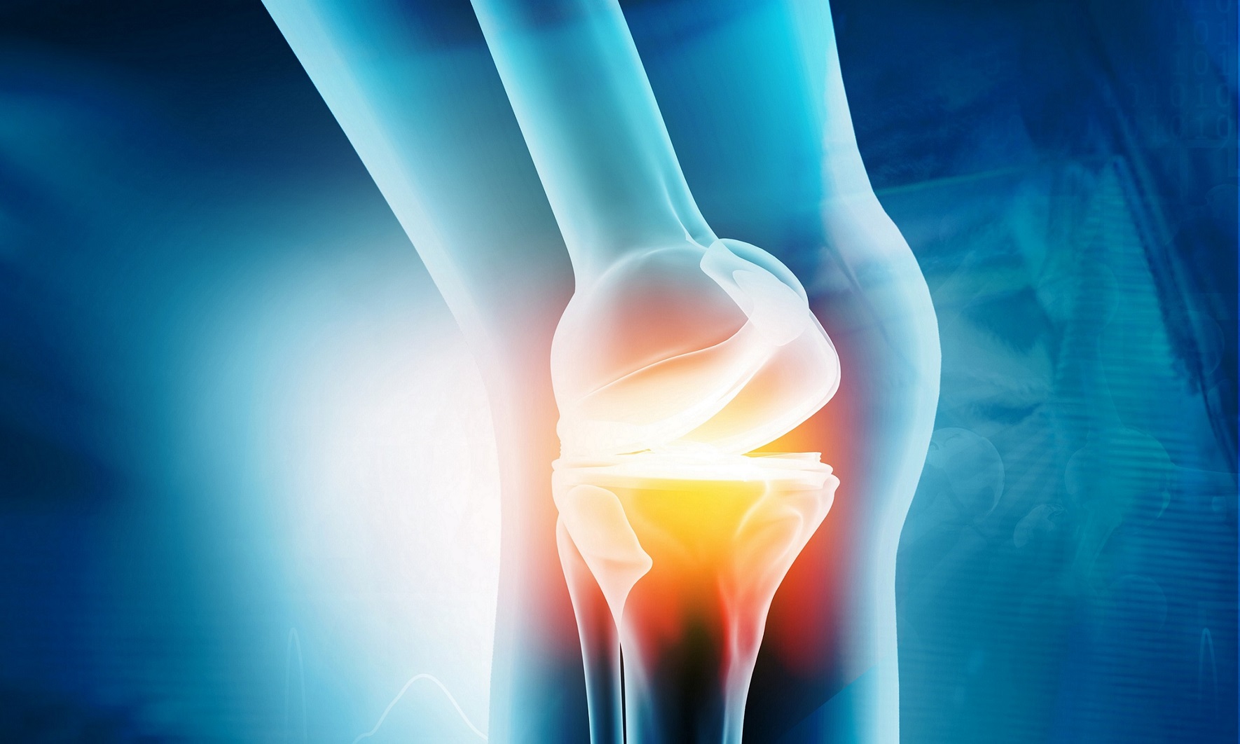 Osteoarthritis